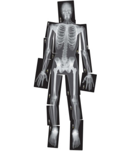 RTG snímky lidské kostry