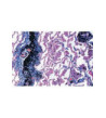 Preparáty - 1× zdravá arterie, 1× arteroskleróza