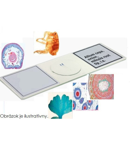 Kvasinka pivní (Saccharomyces cerevisiae), preparát