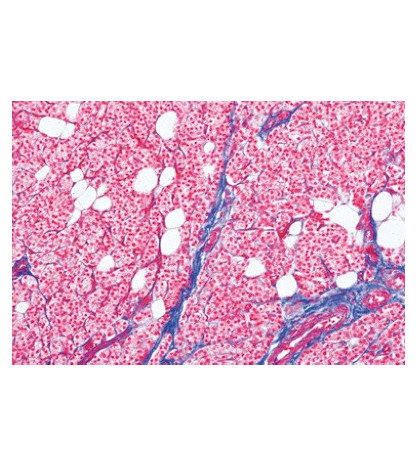 Mikroskopické preparáty - Soubor lidských preparátů - Normální histologie, rozšířená sada