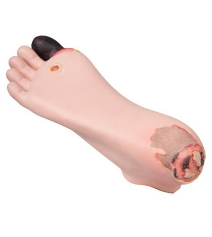 Cvičný model - simulátor vyšetření diabetesu na chodidle