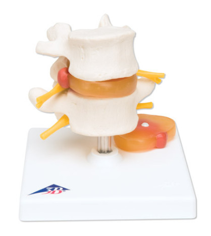 Model - Bederní obratle - plotýnka s herní