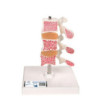 Model osteoporózy – 3 obratle v řezu
