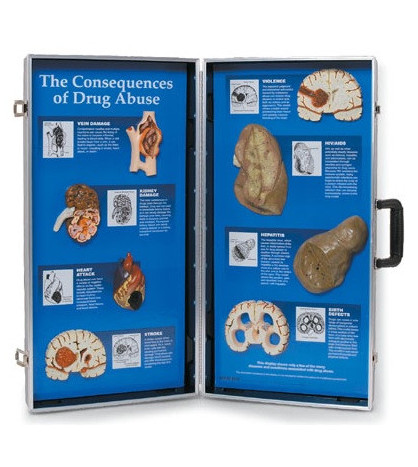 Důsledky drog - 3D panel