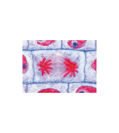 Mikroskopické preparáty - Školní sada A, 25 preparátů