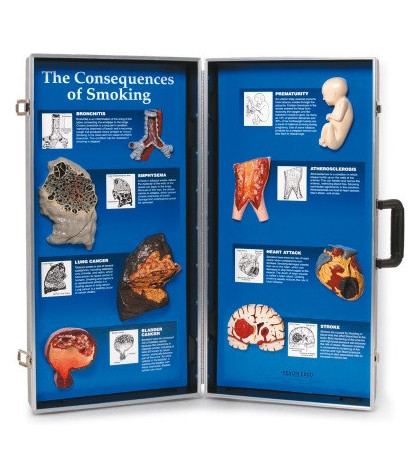 Důsledky kouření - 3D panel